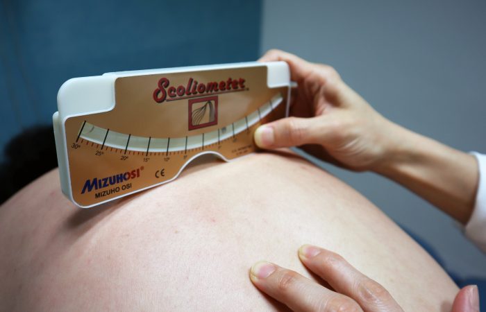 脊柱側彎施羅德運動治療 Scoliosis Schroth Exercise Training