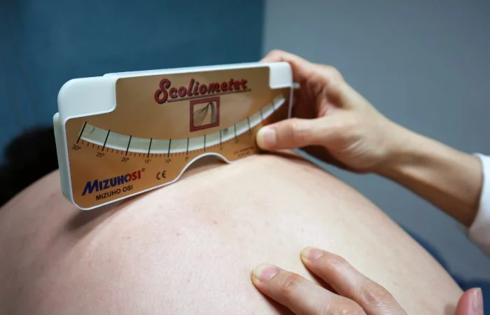 脊柱側彎施羅德運動治療 Scoliosis Schroth Exercise Training