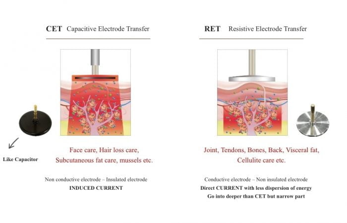 Myofacial Radio Frequency Therapy 肌筋膜深層射頻熱療儀