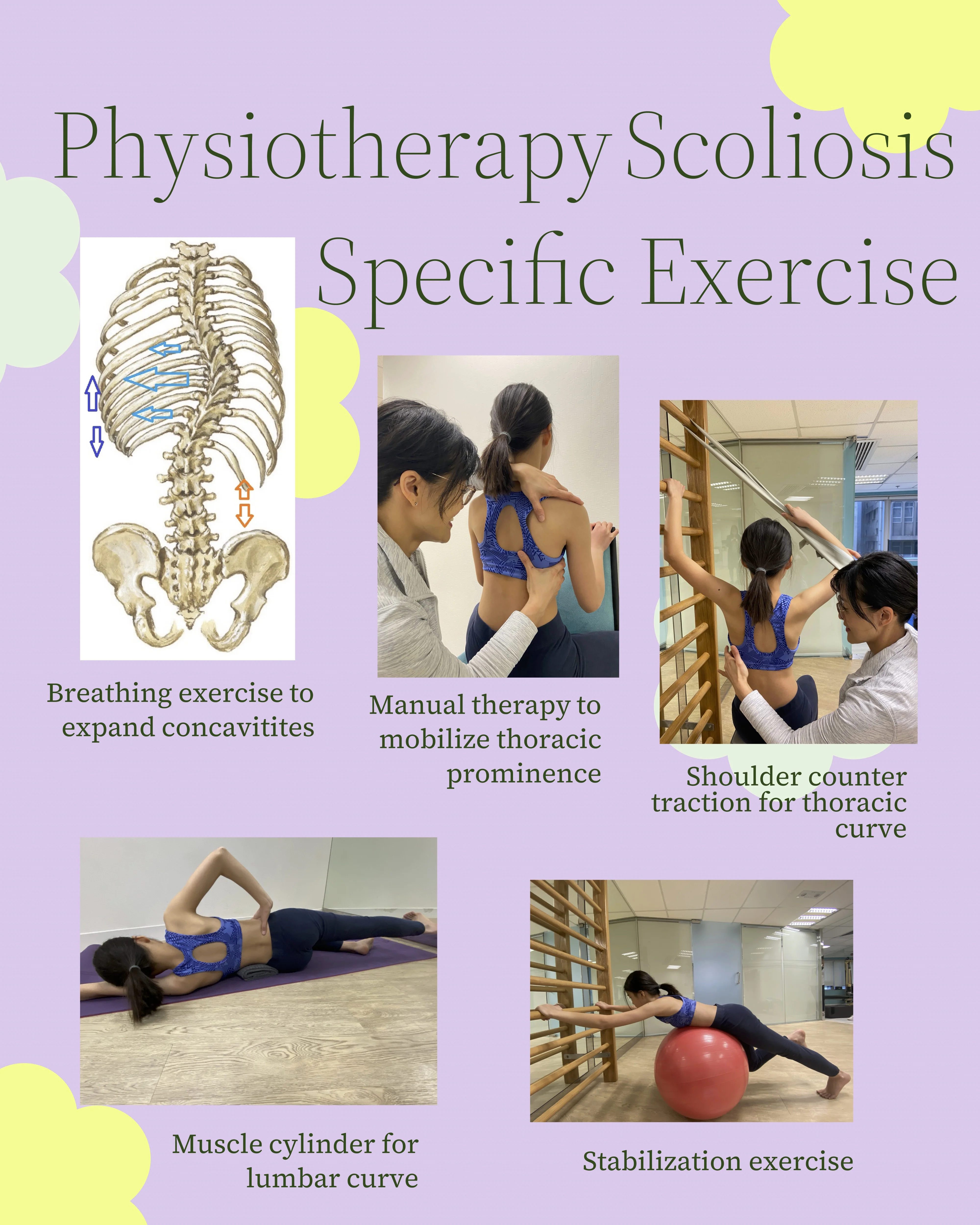 脊柱側彎施羅德運動治療 Scoliosis Schroth Exercise Training